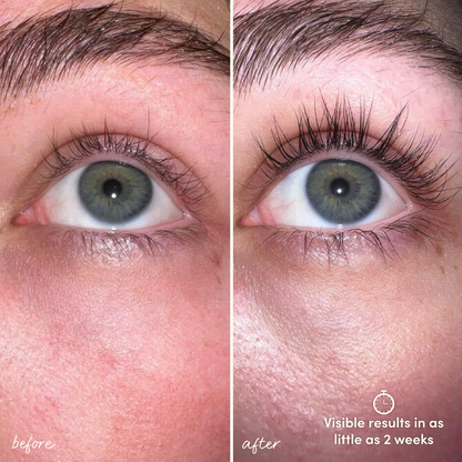 Kelviora™ LashRenew Serum