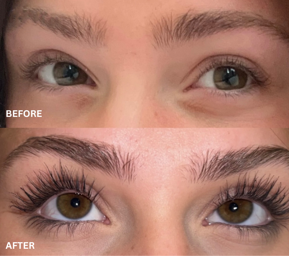 Kelviora™ LashRenew Serum